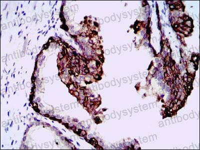 Валидация AntibodySystem RHA05801