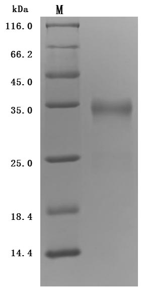 SDS-PAGE