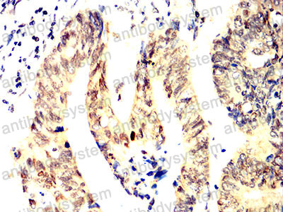 Валидация AntibodySystem RHD50801
