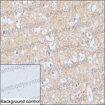 Валидация AntibodySystem RHD60302