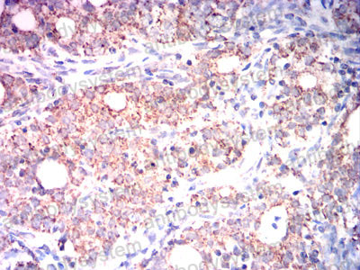 Валидация AntibodySystem RHD01401 (1271)