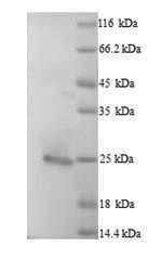 SDS-PAGE