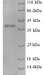 SDS-PAGE