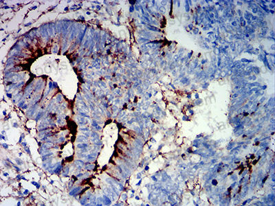 Валидация AntibodySystem RHJ31002