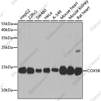 Вестерн-блоттинг, COX5B, различные клеточные линии