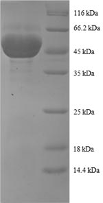 SDS-PAGE