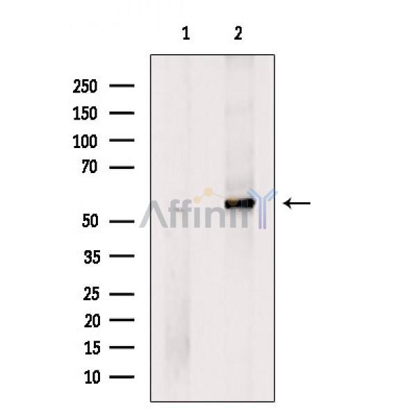 Валидация Affinity DF4985 - 16835