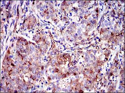 Валидация AntibodySystem RHC06203