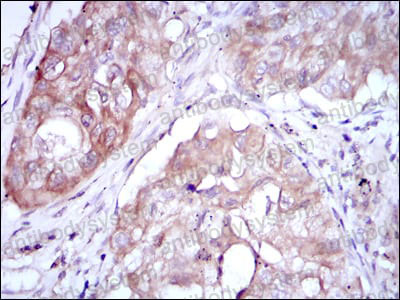 Валидация AntibodySystem RHE38502 (2141)