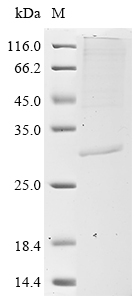 SDS-PAGE