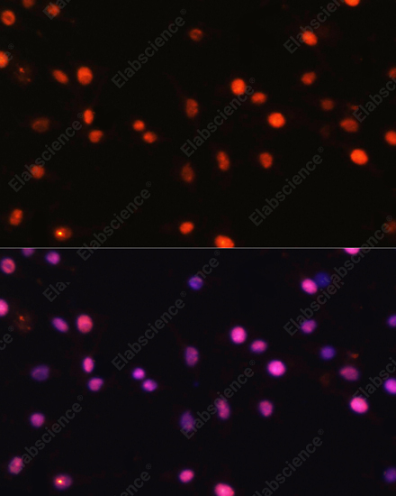 Иммунофлуоресценция, DNMT1, клетки C6