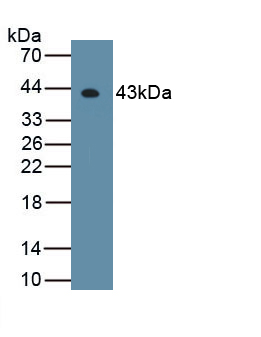 62313