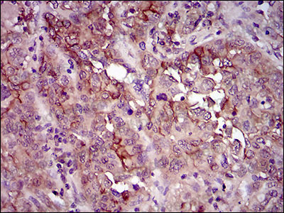 Валидация AntibodySystem RHD37502