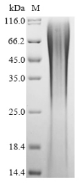 SDS-PAGE