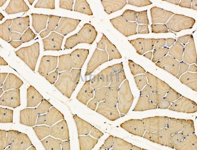 Валидация Affinity DF15156 - 11424