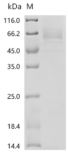 SDS-PAGE