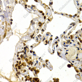 Иммуногистохимия, TFDP1, ткань легкого человека