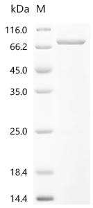 SDS-PAGE