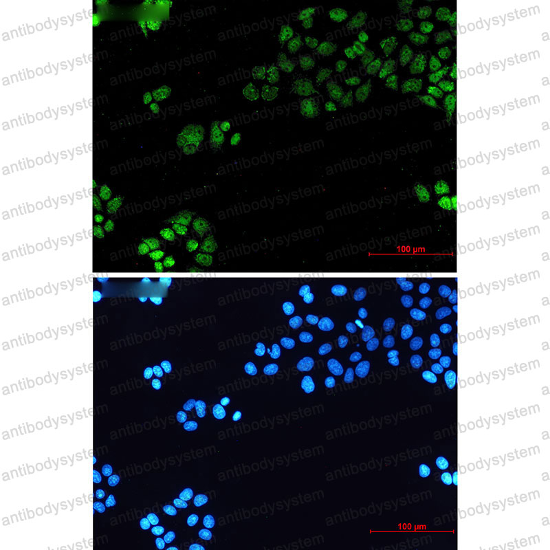 Валидация IF - AntibodySystem RHD38001