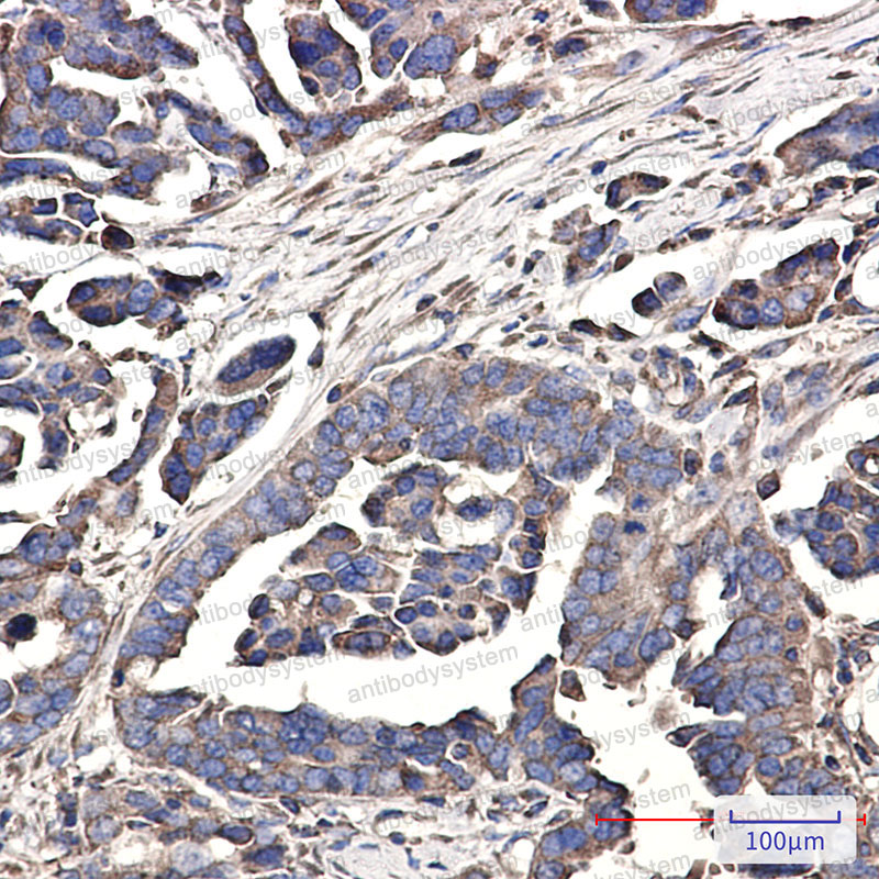 Валидация AntibodySystem RHB08101