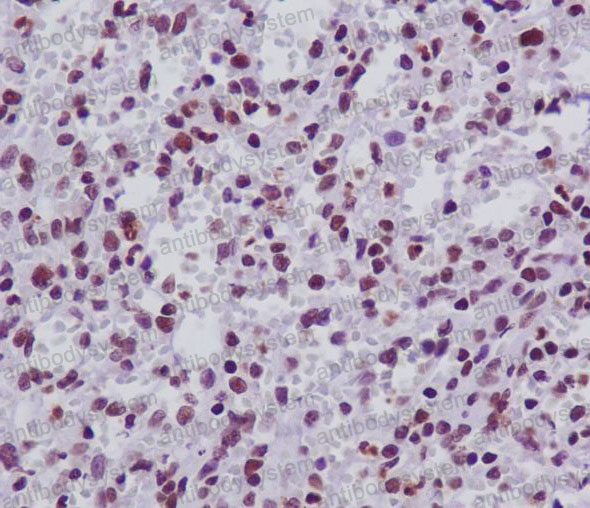 Валидация AntibodySystem RHN61001