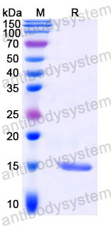 Валидация SDS-PAGE - AntibodySystem RZZ01804