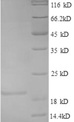 SDS-PAGE