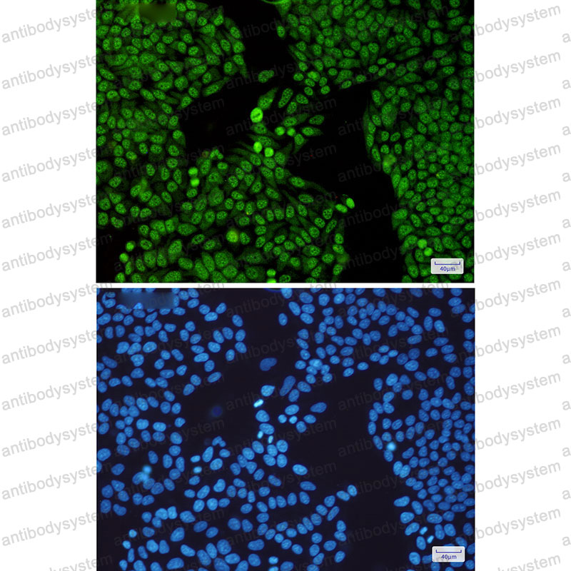Валидация IF - AntibodySystem RHH08601
