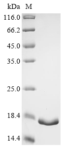 SDS-PAGE