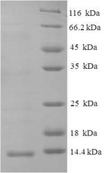 SDS-PAGE