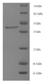 SDS-PAGE
