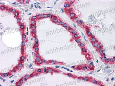 Валидация AntibodySystem RHC84902 (1112)