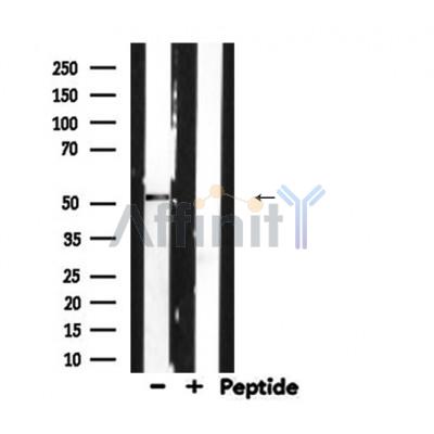 Валидация Affinity AF9265 - 5086