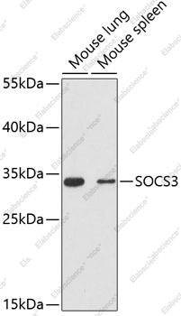Вестерн-блоттинг, SOCS3, различные клеточные линии