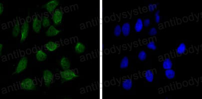 Валидация IF - AntibodySystem RHG31802