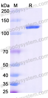 AHG31401, SDS-PAGE