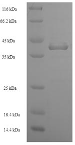 SDS-PAGE