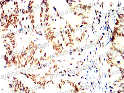 Валидация AntibodySystem RHD14102