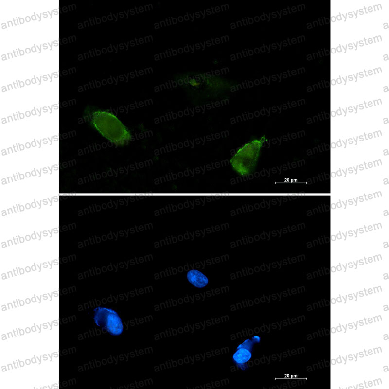 Валидация IF - AntibodySystem RHA14005