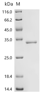 SDS-PAGE