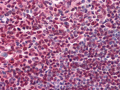 Валидация AntibodySystem RHC90702