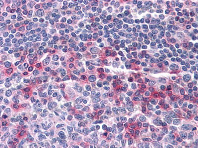 Валидация AntibodySystem RHG11601