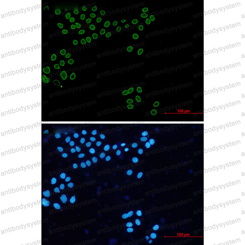 Валидация IF - AntibodySystem RHB98202