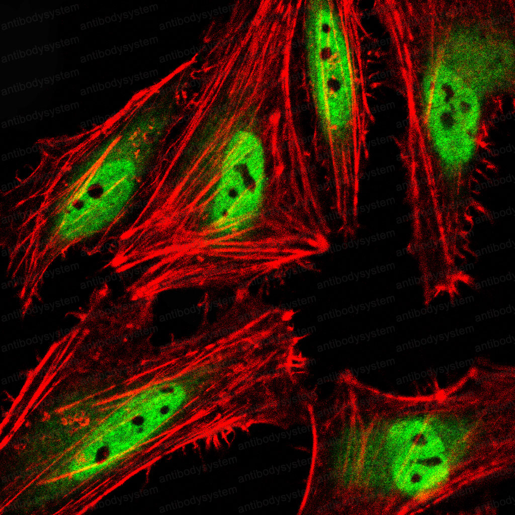 Валидация IF - AntibodySystem RHF42903