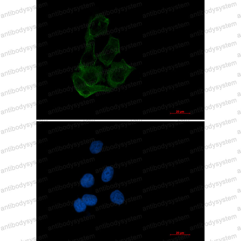 Валидация IF - AntibodySystem RHD34401