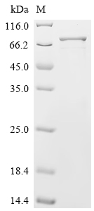 SDS-PAGE