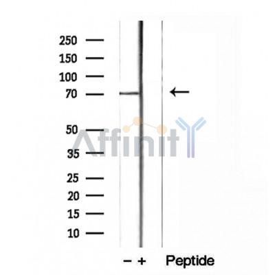 Валидация Affinity DF12079 - 6161