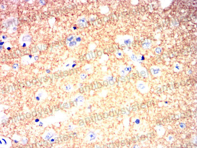 Валидация AntibodySystem RHF56704 (2569)