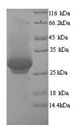 SDS-PAGE