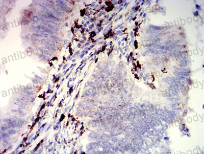 Валидация AntibodySystem RHJ70110